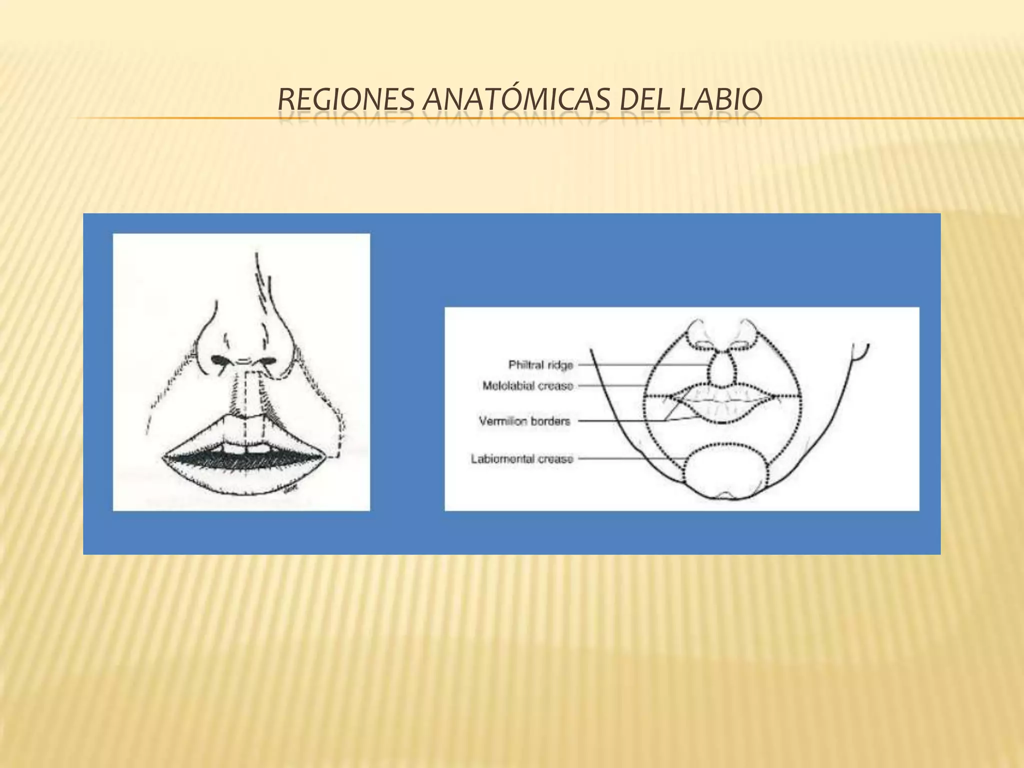 Cancer de labio y reconstruccion | PPTX
