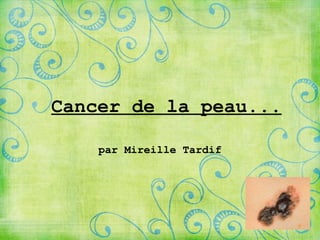 Cancer de la peau... par Mireille Tardif 