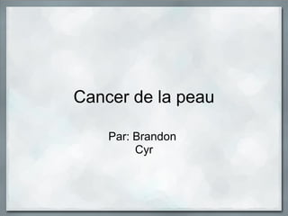 Cancer de la peau
Par: Brandon
Cyr
 