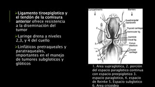 Ligamento tiroepiglotico y
el tendón de la comisura
anterior ofrece resistencia
a la diseminación del
tumor
Laringe drena a niveles
2,3, y 4 del cuello
Linfáticos pretraqueales y
paratraqueales,
importantes en el manejo
de tumores subgloticos y
glóticos
1. Area supraglotica, 2. porción
del espacio paraglotico continua
con espacio preepiglotico 3.
espacio paraglotico, 4. espacio
de Reinke 5. Espacio subglotico
6. Area cricoidea
 