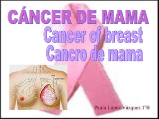 CÁNCER DE MAMA Cancer of breast Paula López Vázquez 1ºB Cancro de mama 