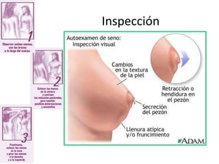 Inspección
 