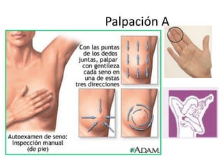 Palpación A
 