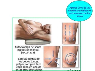 Apenas 20% de las
              mujeres se realizan el
               auto-examen de los
                      senos




Palpación B
 