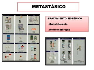 METASTÁSICO

     TRATAMIENTO SISTÉMICO

     . Quimioterapia

     . Hormonoterapia
 