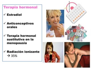Terapia hormonal

 Estradiol

 Anticonceptivos
  orales

 Terapia hormonal
  sustitutiva en la
  menopausia

 Radiación ionizante
   35%
 