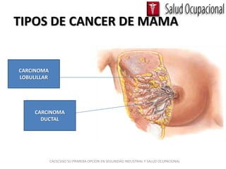 TIPOS DE CANCER DE MAMA


CARCINOMA
LOBULILLAR




     CARCINOMA
       DUCTAL




             CACECSISO SU PRIMERA OPCION EN SEGURIDAD INDUSTRIAL Y SALUD OCUPACIONAL
 