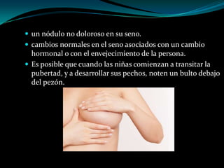  un nódulo no doloroso en su seno.
 cambios normales en el seno asociados con un cambio
  hormonal o con el envejecimiento de la persona.
 Es posible que cuando las niñas comienzan a transitar la
  pubertad, y a desarrollar sus pechos, noten un bulto debajo
  del pezón.
 