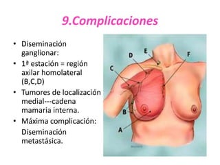 9.Complicaciones
• Diseminación
  ganglionar:
• 1ª estación = región
  axilar homolateral
  (B,C,D)
• Tumores de localización
  medial---cadena
  mamaria interna.
• Máxima complicación:
  Diseminación
  metastásica.
 