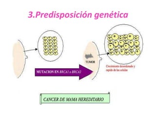 3.Predisposición genética
 