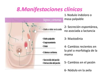 8.Manifestaciones clínicas
                  1- Nodulo indoloro o
                  masa palpable

                  2- Secreción espontánea,
                  no asociada a lactancia

                  3- Mastodinia

                  4- Cambios recientes en
                  la piel o morfología de la
                  mama

                  5- Cambios en el pezón

                  6- Nódulo en la axila
 