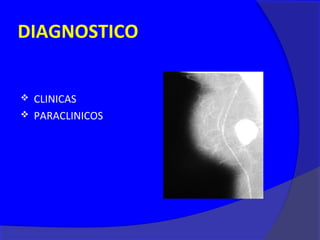 DIAGNOSTICO


 CLINICAS
 PARACLINICOS
 
