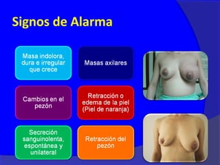 Signos de Alarma
 