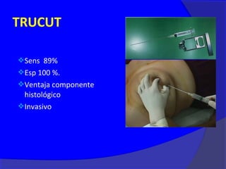 TRUCUT

Sens 89%
Esp 100 %.
Ventaja componente
 histológico
Invasivo
 