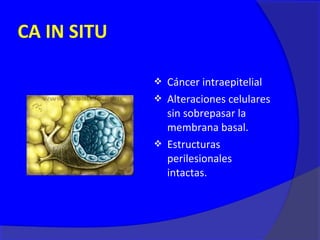 CA IN SITU

              Cáncer intraepitelial
              Alteraciones celulares
               sin sobrepasar la
               membrana basal.
              Estructuras
               perilesionales
               intactas.
 