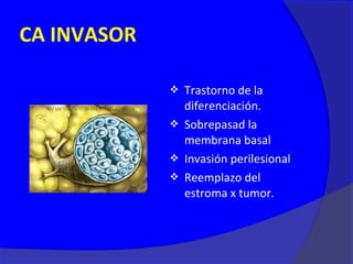 CA INVASOR

              Trastorno de la
               diferenciación.
              Sobrepasad la
               membrana basal
              Invasión perilesional
              Reemplazo del
               estroma x tumor.
 