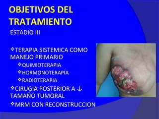 OBJETIVOS DEL
TRATAMIENTO
ESTADIO III

TERAPIA SISTEMICA COMO
MANEJO PRIMARIO
  QUIMIOTERAPIA
  HORMONOTERAPIA
  RADIOTERAPIA
CIRUGIA POSTERIOR A ↓
TAMAÑO TUMORAL
MRM CON RECONSTRUCCION
 