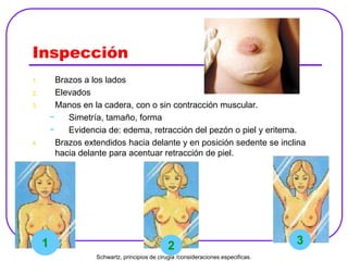 Inspección
1. Brazos a los lados
2. Elevados
3. Manos en la cadera, con o sin contracción muscular.
- Simetría, tamaño, forma
- Evidencia de: edema, retracción del pezón o piel y eritema.
4. Brazos extendidos hacia delante y en posición sedente se inclina
hacia delante para acentuar retracción de piel.
1 32
Schwartz, principios de cirugia /consideraciones especificas.
 