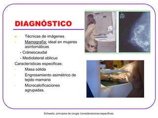 DIAGNÓSTICO
 Técnicas de imágenes
1. Mamografía: ideal en mujeres
asintomáticas
- Cráneocaudal
- Mediolateral oblicuo
Características especificas:
• Masa sólida
• Engrosamiento asimétrico de
tejido mamario
• Microcalcificaciones
agrupadas.
Schwartz, principios de cirugia /consideraciones especificas.
 