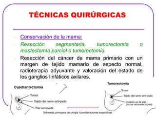 TÉCNICAS QUIRÚRGICAS
- Conservación de la mama:
- Resección segmentaria, tumorectomía o
mastectomía parcial o tumorectomía.
- Resección del cáncer de mama primario con un
margen de tejido mamario de aspecto normal,
radioterapia adyuvante y valoración del estado de
los ganglios linfáticos axilares.
TÉCNICAS QUIRÚRGICAS
- Conservación de la mama:
- Resección segmentaria, tumorectomía o
mastectomía parcial o tumorectomía.
- Resección del cáncer de mama primario con un
margen de tejido mamario de aspecto normal,
radioterapia adyuvante y valoración del estado de
los ganglios linfáticos axilares.
TÉCNICAS QUIRÚRGICAS
Schwartz, principios de cirugia /consideraciones especificas.
 