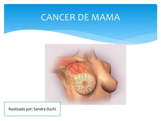 CANCER DE MAMA
Realizado por: Sandra Duchi
 