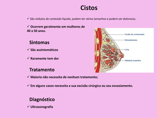 Cistos
 São nódulos de conteúdo líquido, podem ter vários tamanhos e podem ser dolorosos.
 Ocorrem geralmente em mulheres de
40 a 50 anos.
Sintomas
 São assintomáticos
 Raramente tem dor
Tratamento
 Maioria não necessita de nenhum tratamento;
 Em alguns casos necessita a sua excisão cirúrgica ou seu esvaziamento.
Diagnóstico
 Ultrasonografia
 