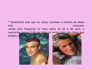 * Geralmente este tipo de câncer acomete o homem de idade
mais avançada.
sendo mais freqüente na faixa etária de 50 e 60 anos, e
representa apenas 0.6% de todos os outros tipos de câncer que
atingem o homem.
 