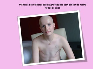 Milhares de mulheres são diagnosticadas com câncer de mama
todos os anos
 