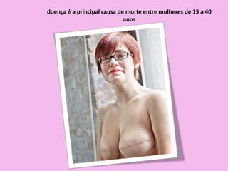 doença é a principal causa de morte entre mulheres de 15 a 40
anos
 