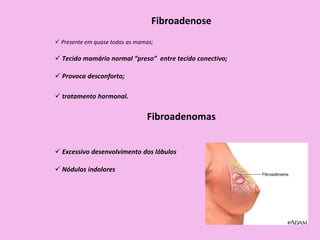  Presente em quase todas as mamas;
Fibroadenose
 Tecido mamário normal “preso” entre tecido conectivo;
 Provoca desconforto;
 tratamento hormonal.
Fibroadenomas
 Excessivo desenvolvimento dos lóbulos
 Nódulos indolores
 