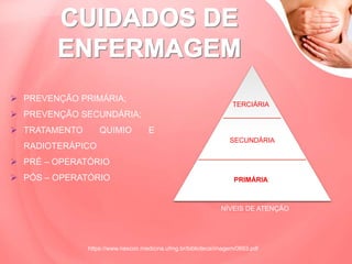  PREVENÇÃO PRIMÁRIA;
 PREVENÇÃO SECUNDÁRIA;
 TRATAMENTO QUIMIO E
RADIOTERÁPICO
 PRÉ – OPERATÓRIO
 PÓS – OPERATÓRIO
https://www.nescon.medicina.ufmg.br/biblioteca/imagem/0693.pdf
PRIMÁRIA
SECUNDÁRIA
TERCIÁRIA
NÍVEIS DE ATENÇÃO
 