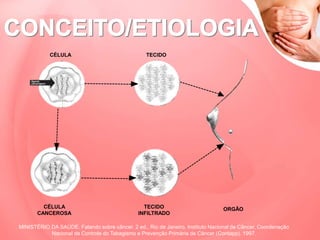 CÉLULA
CÉLULA
CANCEROSA
TECIDO
TECIDO
INFILTRADO
ORGÃO
MINISTÉRIO DA SAÚDE. Falando sobre câncer. 2 ed., Rio de Janeiro, Instituto Nacional de Câncer, Coordenação
Nacional de Controle do Tabagismo e Prevenção Primária de Câncer (Contapp). 1997.
 