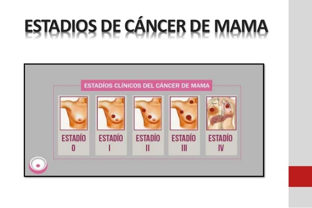 Estadiaje Cancer De Mama
