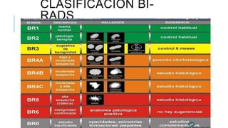 CLASIFICACIÓN BI-
RADS
 