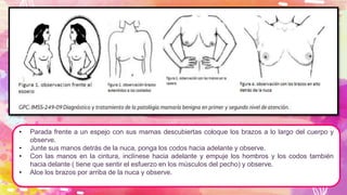 • Parada frente a un espejo con sus mamas descubiertas coloque los brazos a lo largo del cuerpo y
observe.
• Junte sus manos detrás de la nuca, ponga los codos hacia adelante y observe.
• Con las manos en la cintura, inclínese hacia adelante y empuje los hombros y los codos también
hacia delante ( tiene que sentir el esfuerzo en los músculos del pecho) y observe.
• Alce los brazos por arriba de la nuca y observe.
 
