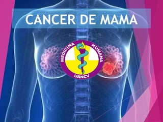 CANCER DE MAMA
 
