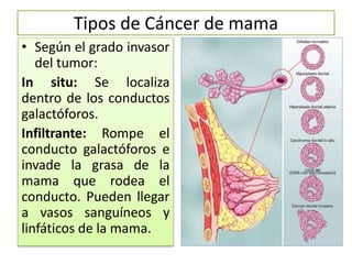 Tipos de Cáncer de mama
• Según el grado invasor
del tumor:
In situ: Se localiza
dentro de los conductos
galactóforos.
Infiltrante: Rompe el
conducto galactóforos e
invade la grasa de la
mama que rodea el
conducto. Pueden llegar
a vasos sanguíneos y
linfáticos de la mama.
 