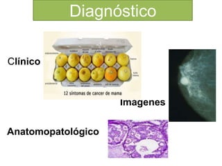 Diagnóstico
Clínico
Anatomopatológico
Imágenes
 