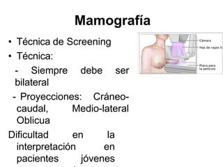 Mamografía
• Técnica de Screening
• Técnica:
- Siempre debe ser
bilateral
- Proyecciones: Cráneo-
caudal, Medio-lateral
Oblicua
Dificultad en la
interpretación en
pacientes jóvenes
 