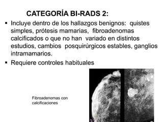 CATEGORÍA BI-RADS 2:
 Incluye dentro de los hallazgos benignos: quistes
simples, prótesis mamarias, fibroadenomas
calcificados o que no han variado en distintos
estudios, cambios posquirúrgicos estables, ganglios
intramamarios.
 Requiere controles habituales
Fibroadenomas con
calcificaciones
 