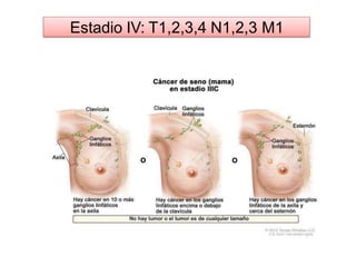Estadio IV: T1,2,3,4 N1,2,3 M1
 