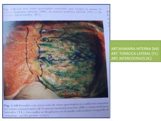 ART.MAMARIA INTERNA (MI)
ART. TORÁCICA LATERAL (TL)
ART. INTERCOSTALES (IC)
 