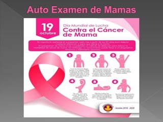 CANCER DE MAMA .pptx