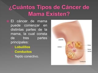  Las células cancerosas se originan en los
lobulillos y después se diseminan de los
lobulillos a los tejidos mamarios cer...