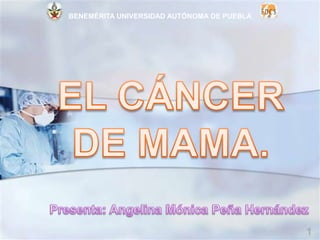 EL CÁNCER DE MAMA. Presenta: Angelina Mónica Peña Hernández  1 