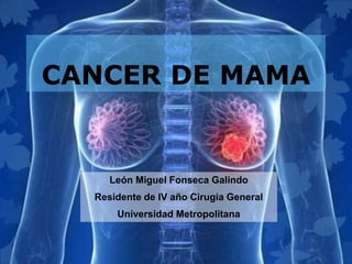 CANCER DE MAMA
León Miguel Fonseca Galindo
Residente de IV año Cirugía General
Universidad Metropolitana
 