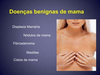 Doenças benignas de mama

Displasia Mamária

      Nódulos de mama

 Fibroadenoma

        Mastites

 Cistos de mama
 