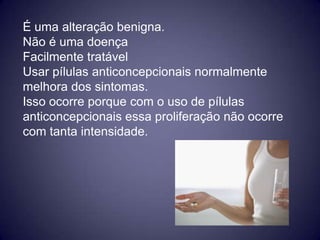 É uma alteração benigna.
Não é uma doença
Facilmente tratável
Usar pílulas anticoncepcionais normalmente
melhora dos sintomas.
Isso ocorre porque com o uso de pílulas
anticoncepcionais essa proliferação não ocorre
com tanta intensidade.
 