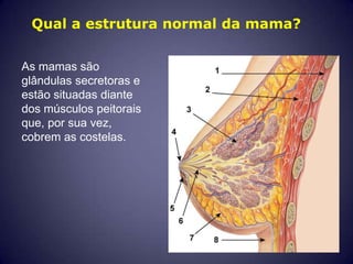 Qual a estrutura normal da mama?


As mamas são
glândulas secretoras e
estão situadas diante
dos músculos peitorais
que, por sua vez,
cobrem as costelas.
 
