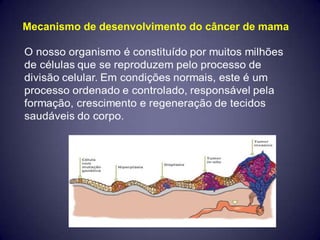 Mecanismo de desenvolvimento do câncer de mama
 